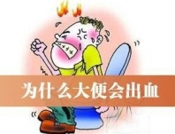 大便出血